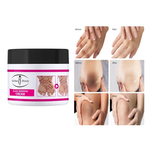 CREMA BLANQUEADORA DE ARTICULACIONES, PARA ELIMINAR MANCHAS DE RODILLAS Y CODOS