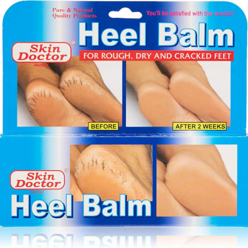 Crema bálsamo para talones
